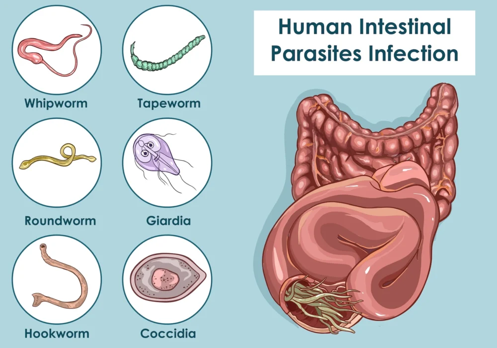 Parasites in the Gut