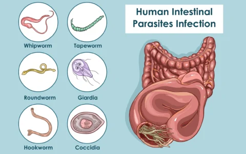 How do Parasites effects the Gut?